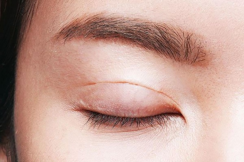 Vai trò của phẫu thuật mắt trong y khoa hiện đại