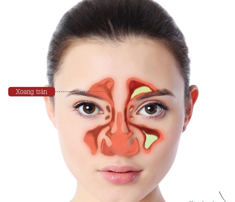 Tầm quan trọng của nội soi trong chẩn đoán và điều trị bệnh lý dạ dày
