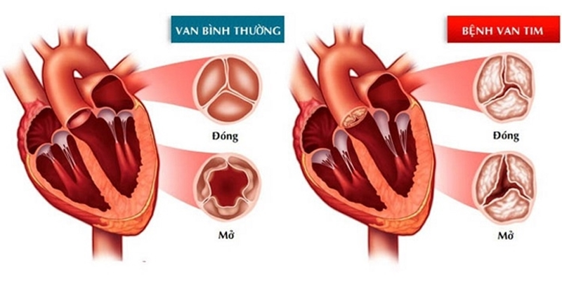 Tầm quan trọng của nội soi trong chẩn đoán và điều trị bệnh lý dạ dày
