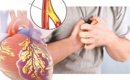Tầm quan trọng của nội soi trong chẩn đoán và điều trị bệnh lý dạ dày