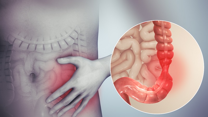 Giải pháp điều trị hiệu quả