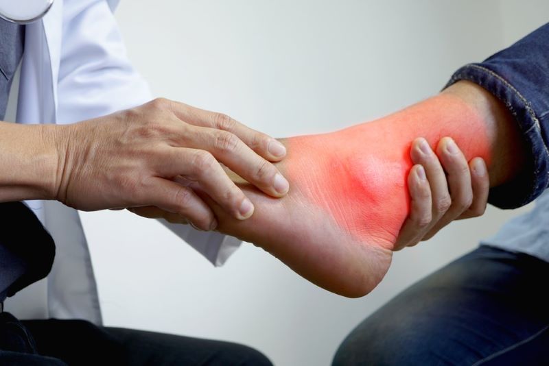 Điều trị bệnh gout hiệu quả