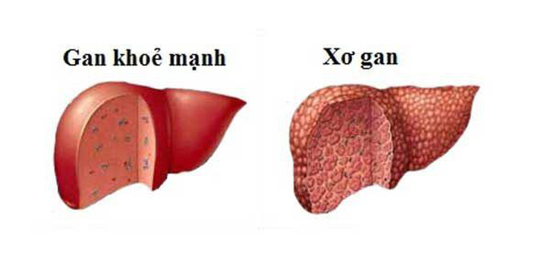 Vai trò của gan trong cơ thể