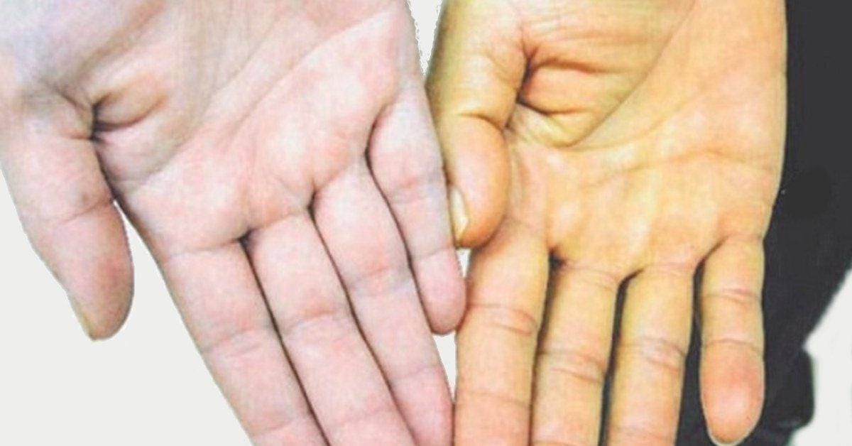 Tầm quan trọng của nội soi trong chẩn đoán và điều trị bệnh lý dạ dày
