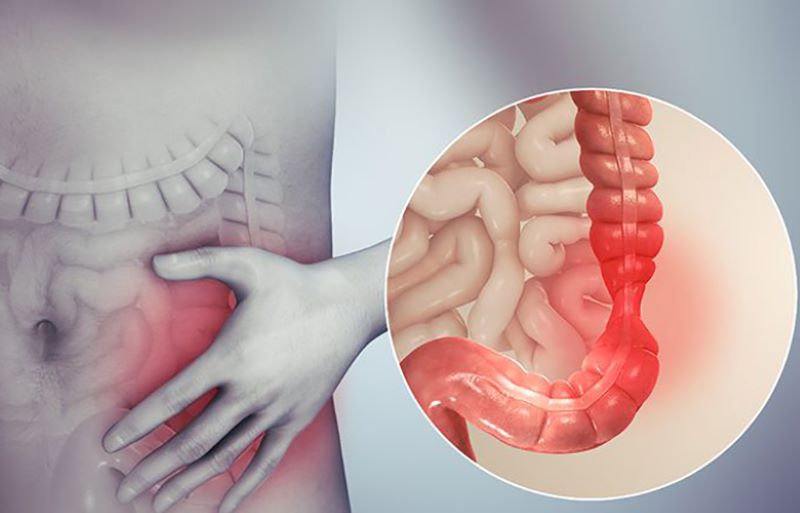 Tầm quan trọng của nội soi trong chẩn đoán và điều trị bệnh lý dạ dày
