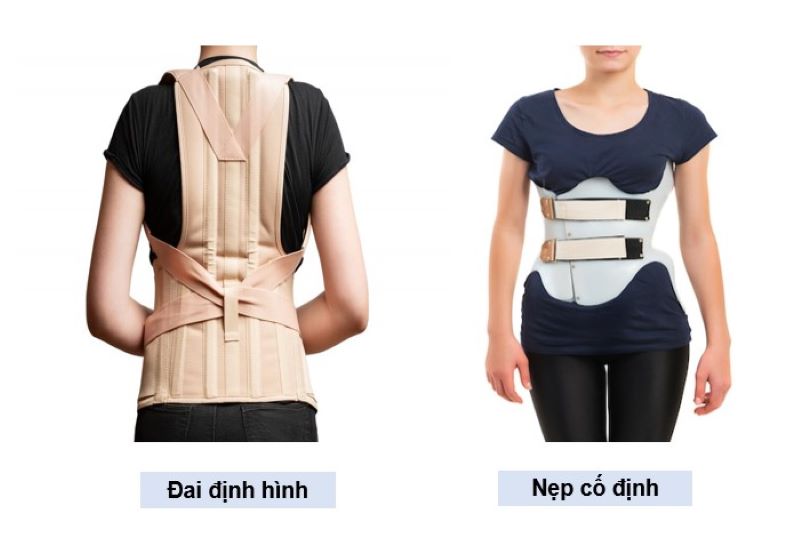 Ảnh hưởng của vẹo cột sống đến sức khỏe