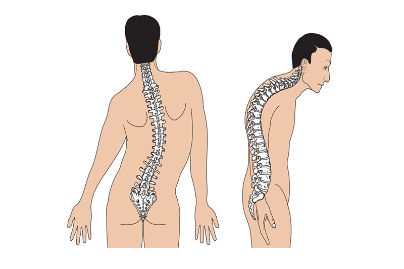 Tầm quan trọng của nội soi trong chẩn đoán và điều trị bệnh lý dạ dày