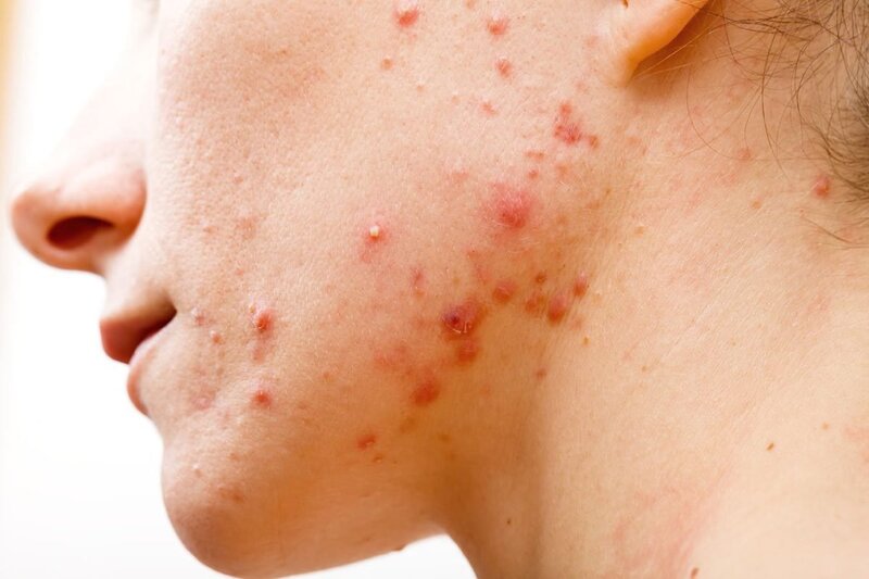 Tầm quan trọng của nội soi trong chẩn đoán và điều trị bệnh lý dạ dày