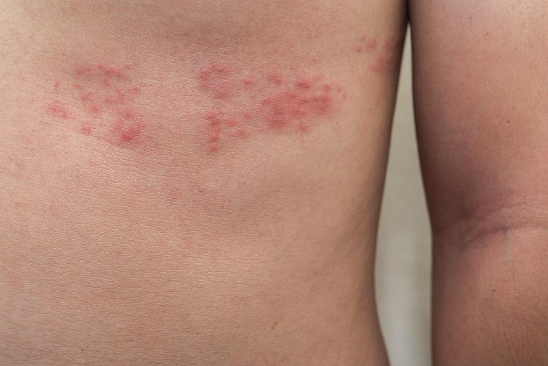 Chẩn đoán bệnh thần kinh ở trẻ