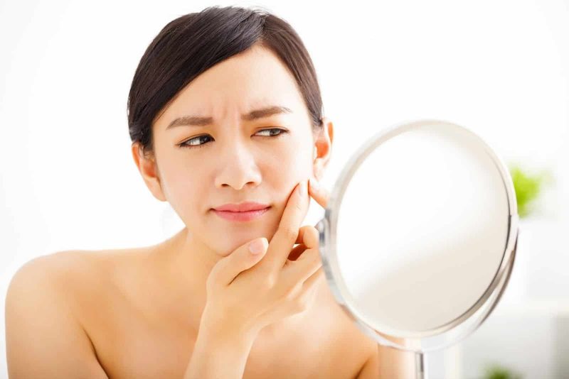Dinh dưỡng và lối sống giúp kiểm soát mụn từ bên trong