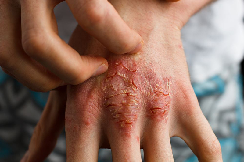 Tầm quan trọng của nội soi trong chẩn đoán và điều trị bệnh lý dạ dày