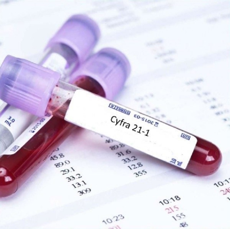MEDLATEC An Khánh – Địa chỉ uy tín trong lĩnh vực xét nghiệm y khoa