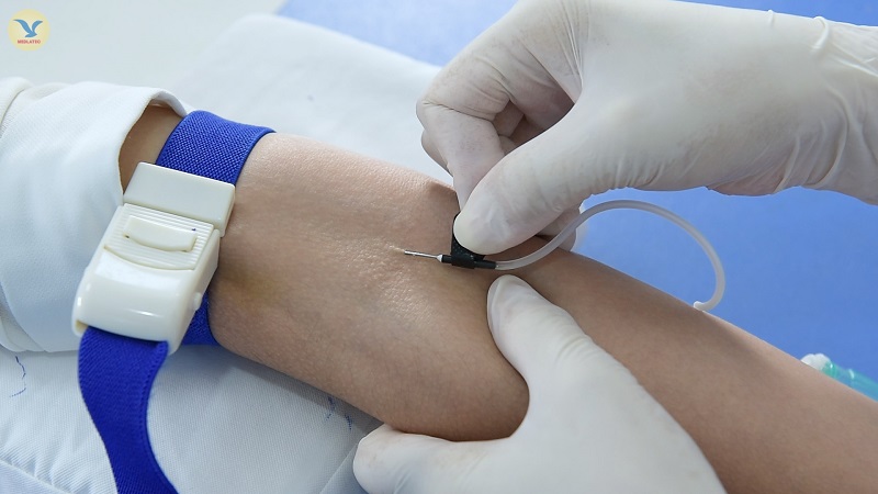 Tầm quan trọng của nội soi trong chẩn đoán và điều trị bệnh lý dạ dày