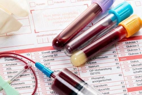 Các loại xét nghiệm phổ biến tại MEDLATEC Phủ Lý