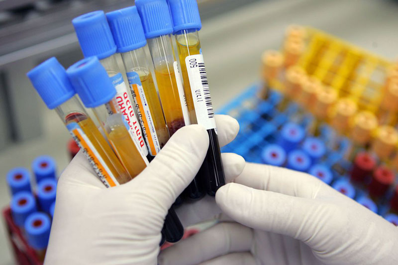 Tầm quan trọng của nội soi trong chẩn đoán và điều trị bệnh lý dạ dày