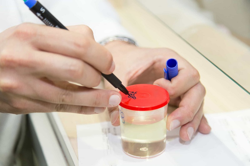 Quy trình lấy mẫu xét nghiệm tại nhà trong 1 giờ