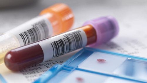 Các gói xét nghiệm phổ biến tại MEDLATEC Ka Long