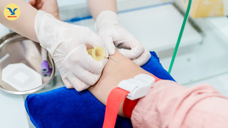 Tầm quan trọng của nội soi trong chẩn đoán và điều trị bệnh lý dạ dày