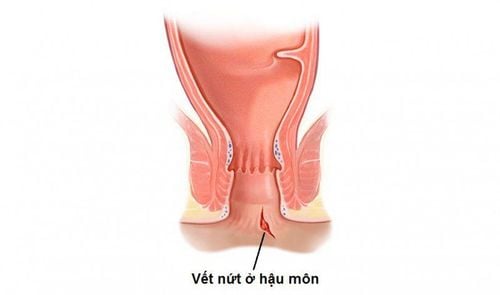 Tầm quan trọng của nội soi trong chẩn đoán và điều trị bệnh lý dạ dày