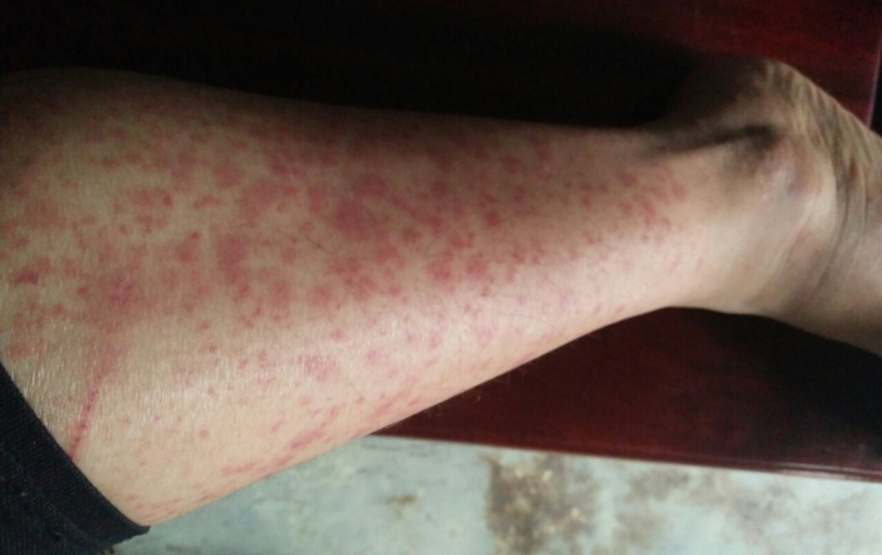 Tầm quan trọng của nội soi trong chẩn đoán và điều trị bệnh lý dạ dày