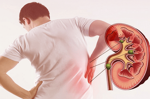 Tầm quan trọng của nội soi trong chẩn đoán và điều trị bệnh lý dạ dày