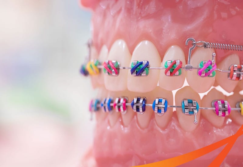 Vì sao nên lựa chọn niềng răng và trồng Implant tại Phòng khám Thu Cúc Đại Từ