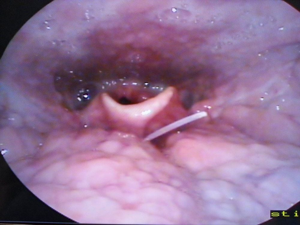 Các bệnh lý Tai Mũi Họng phổ biến ở trẻ em được điều trị tại phòng khám