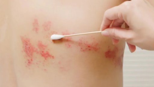 Liệu trình điều trị chuyên biệt cho từng bệnh lý