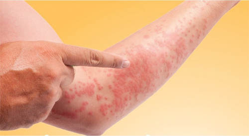 Tầm quan trọng của nội soi trong chẩn đoán và điều trị bệnh lý dạ dày