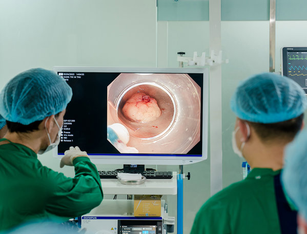 Tầm quan trọng của nội soi trong chẩn đoán và điều trị bệnh lý dạ dày