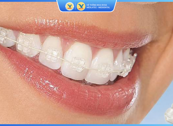 Tầm quan trọng của nội soi trong chẩn đoán và điều trị bệnh lý dạ dày