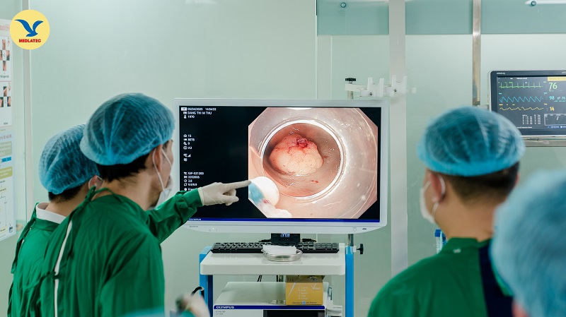 Người thường xuyên gặp triệu chứng rối loạn tiêu hóa