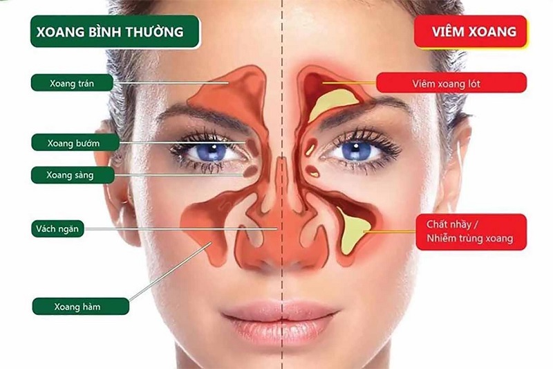 Ảnh hưởng đến sự ph&aacute;t triển của trẻ