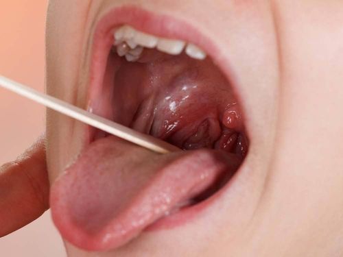 Phương ph&aacute;p chẩn đo&aacute;n tại chuy&ecirc;n khoa Tai Mũi Họng