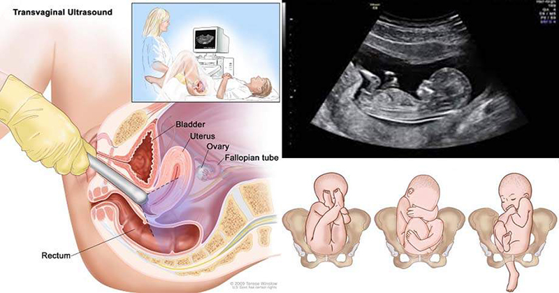 Siêu âm đầu dò: Giải pháp chẩn đoán hình ảnh chính xác