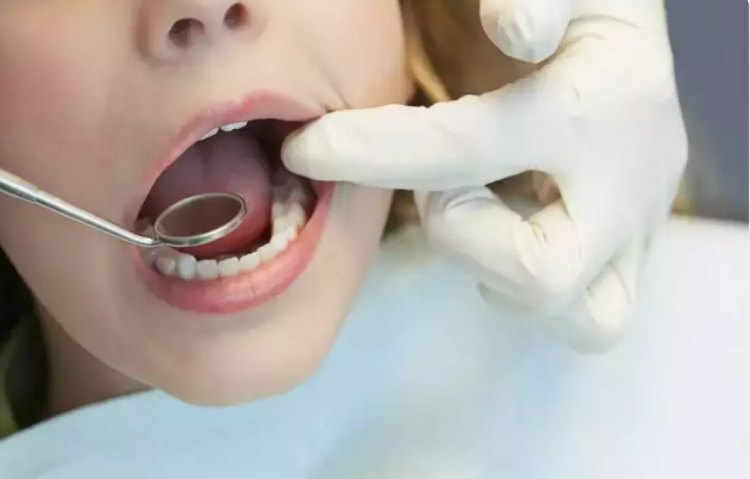 6 dấu hiệu thiếu chất ở miệng cảnh báo sức khỏe bạn không nên bỏ qua
