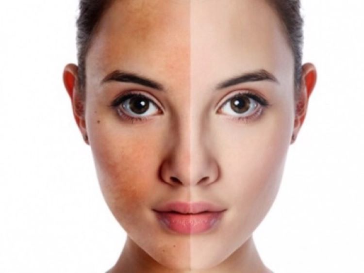 Vì sao da xỉn màu dù bạn đã ngủ đủ giấc? Những nguyên nhân ít ai ngờ tới