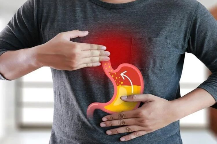 Trào Ngược Dạ Dày – Thực Quản: 9 Dấu Hiệu Nhiều Người Nhầm Với Bệnh Khác